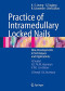 Practice of Intramedullary Locked Nails: New Developments in Techniques and Applications