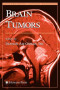 Brain Tumors (Contemporary Cancer Research)