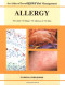 Allergy: An Atlas of Investigation and Diagnosis