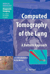Computed Tomography of the Lung: A Pattern Approach (Medical Radiology / Diagnostic Imaging)