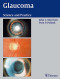 Glaucoma: Science and Practice
