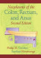 Neoplasms of the Colon, Rectum, and Anus, Second Edition