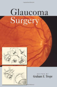 Glaucoma Surgery (Book & DVD)