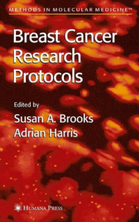 Breast Cancer Research Protocols (Methods in Molecular Medicine)
