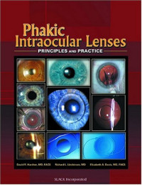 Phakic Intraocular Lenses: Principles and Practice