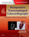 Perioperative Transesophageal Echocardiography: A Companion to Kaplan’s Cardiac Anesthesia (Expert Consult: Online and Print), 1e
