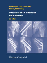 Internal fixation of femoral neck fractures: An Atlas