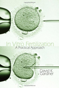 In Vitro Fertilization: A Practical Approach