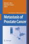 Metastasis of Prostate Cancer (Cancer Metastasis - Biology and Treatment)