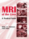 MRI of the Liver: A Practical Guide